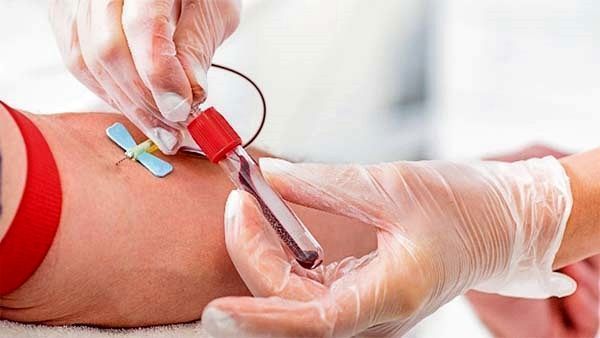 España registra un descenso de nuevos diagnósticos de VIH pero sigue preocupando su retraso