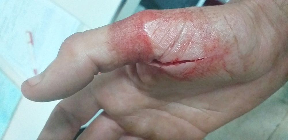 Otra batalla campal entre inmigrantes se salda con un trabajador de las naves en Urgencias.
