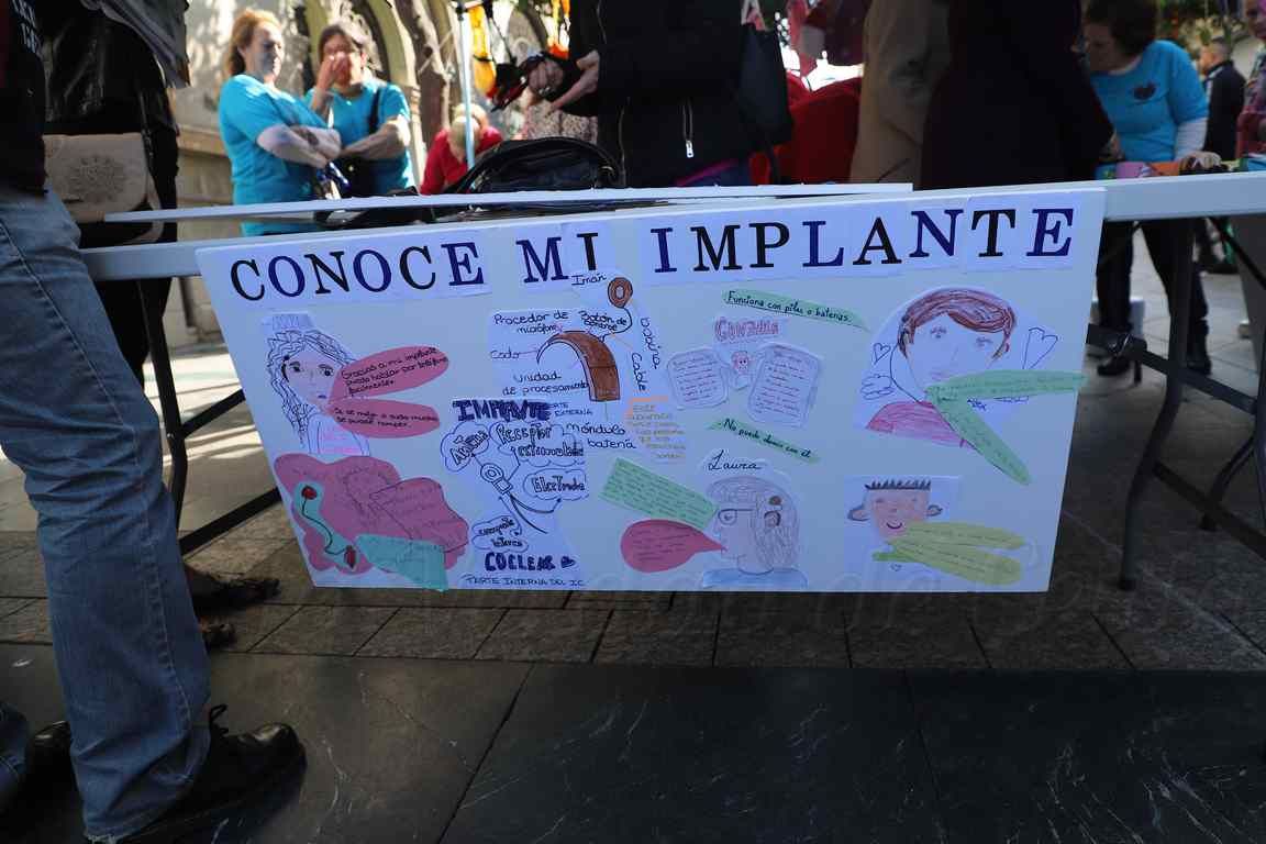VOX propondrá al Pleno crear una partida de ayudas para que los niños con implante coclear puedan adquirir equipos FM