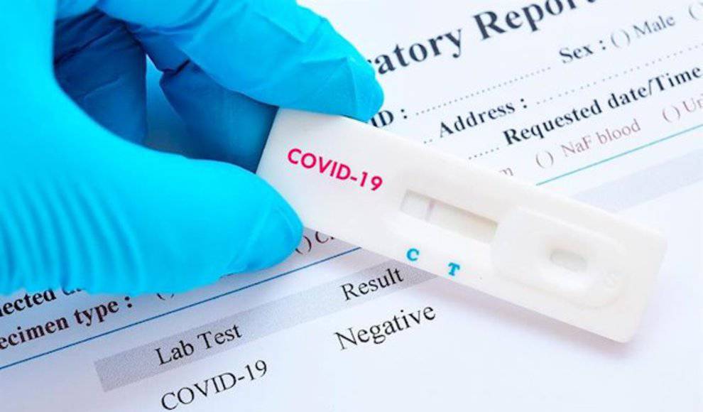 El MDyC pide la extensión los test a todos los sectores expuestos al covid-19