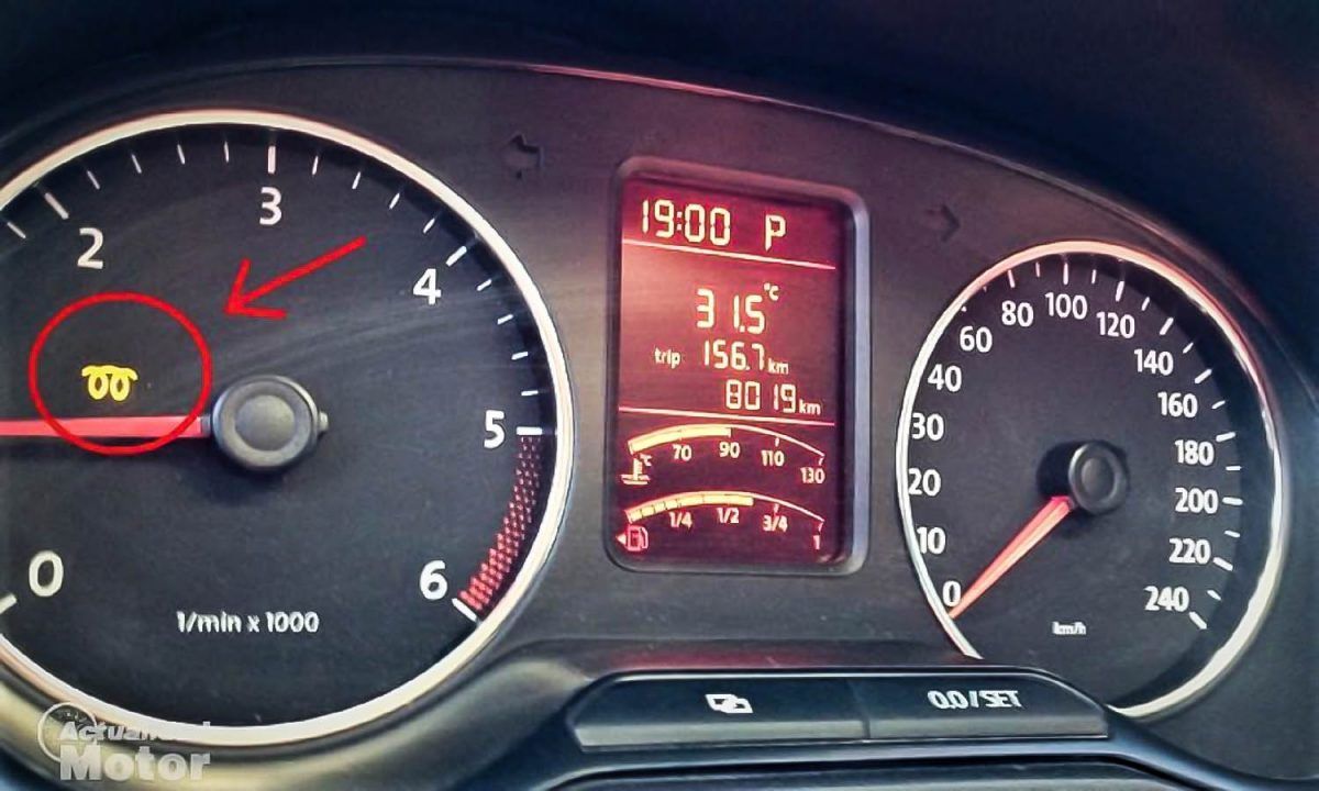 La importancia del mantenimiento del vehículo: las bujías. Imagen:actualidadmotor.com