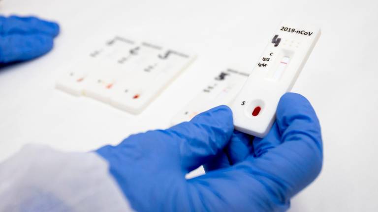 El virus responsable de la covid-19 está muy extendido en la vida silvestre