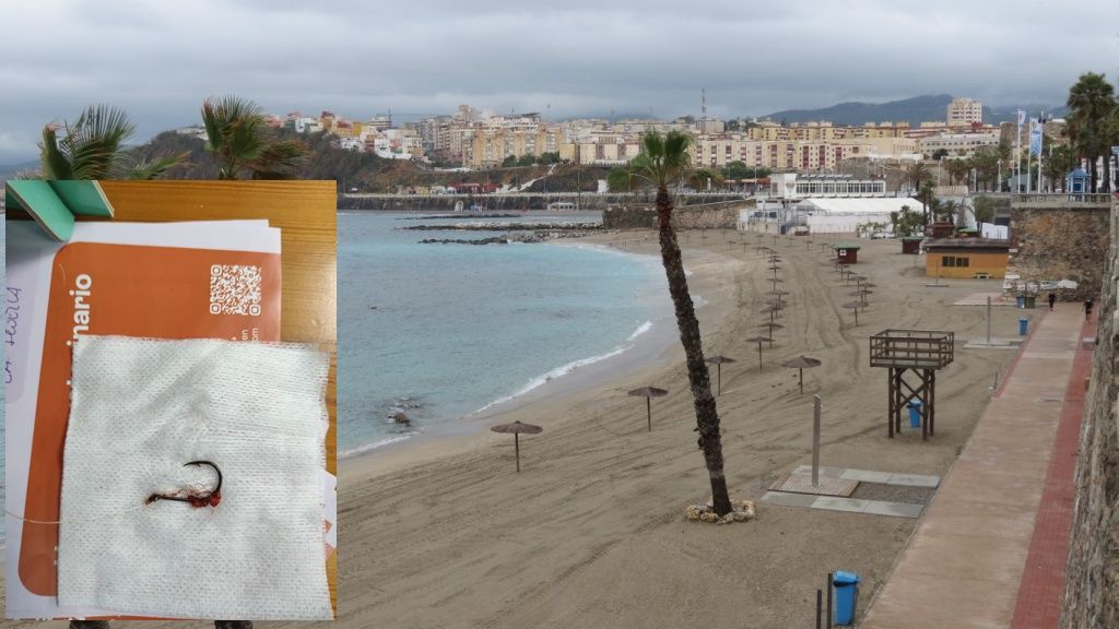 Susto en la playa de La Ribera: un perro se traga un azuelo tirado en la arena